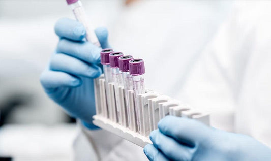 Blog 05: Evexia Lab and Precision Analytical Tests - ClinAdvize